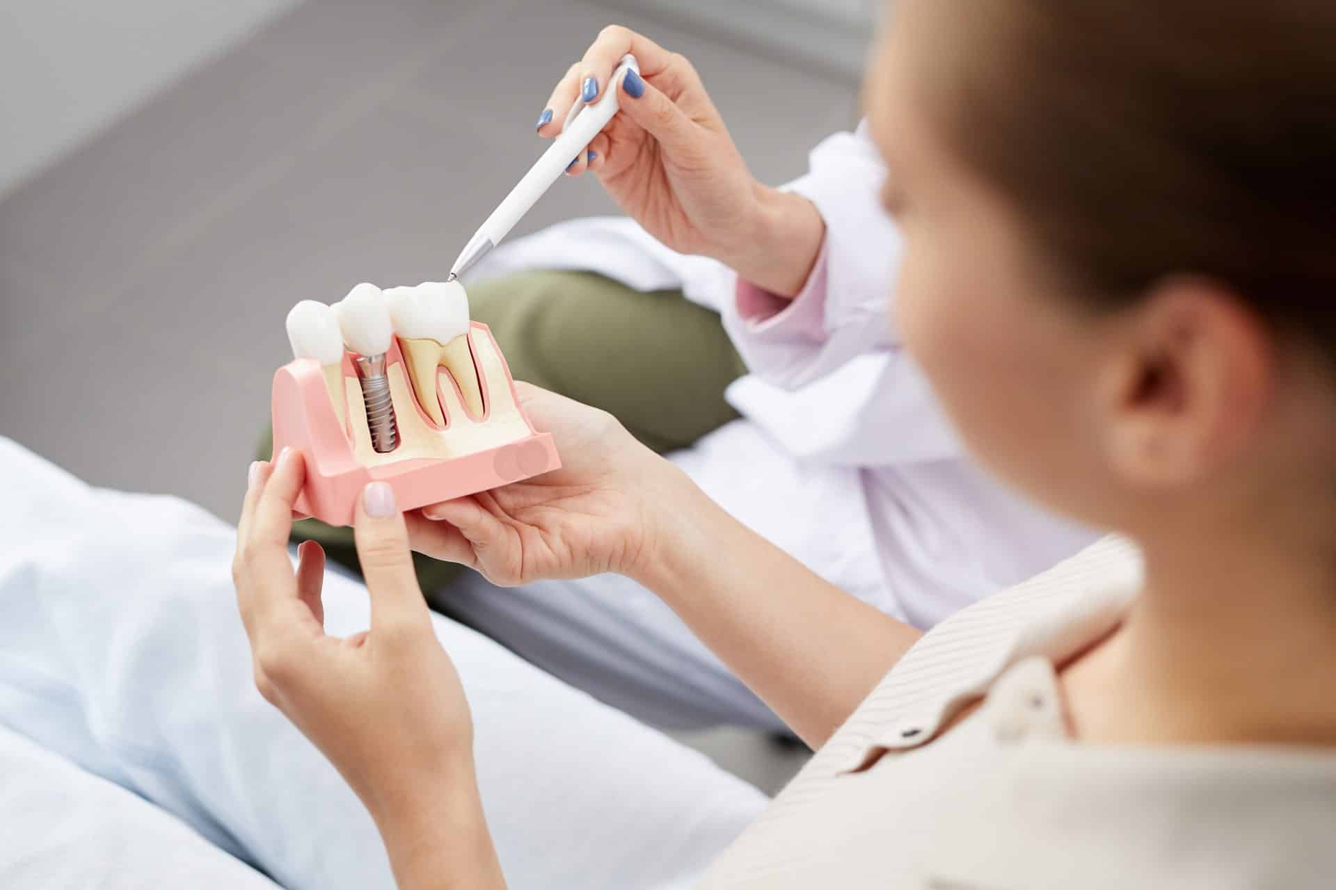 Dentist showing patient a model of dental implants in Singapore - Newlife Dental Practice