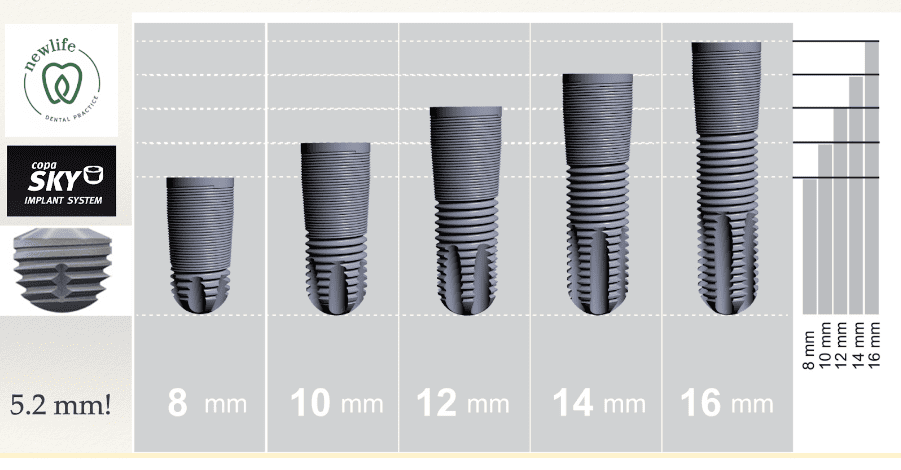 Ultra-short dental implants - Newlife Dental Practice