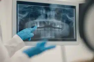 Digital dental X-rays at Newlife Dental Practice